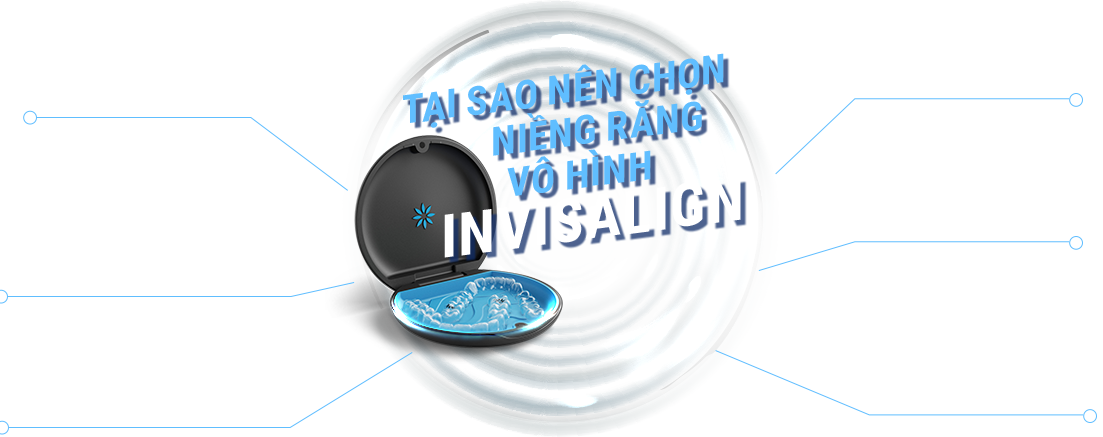 Tại sao chọn niềng răng Invisalign – 6 ưu điểm nổi bật