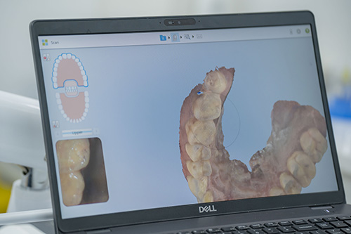 Công nghệ ClinCheck scan 3D dự đoán kết quả