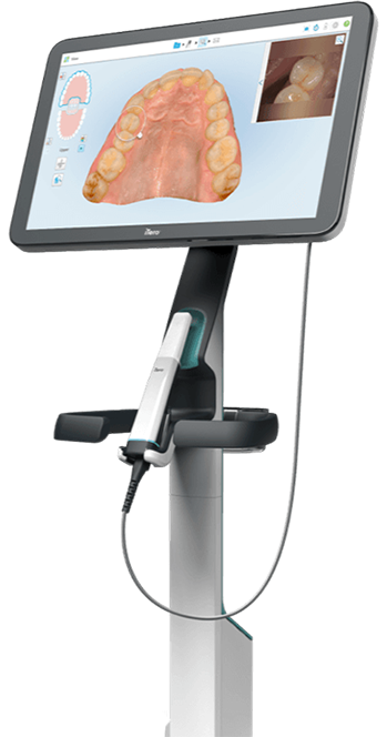 Máy scan iTero Lumina tại Nha Khoa Việt Bỉ