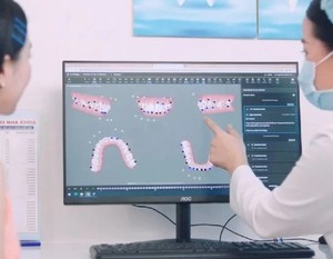 Lên kế hoạch chỉnh nha