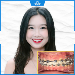 z7500886231157_fed7318bd0e577380ad33f4347f09698