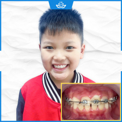 z7502847187442_399fdbc079047402c8904e0dcae59323