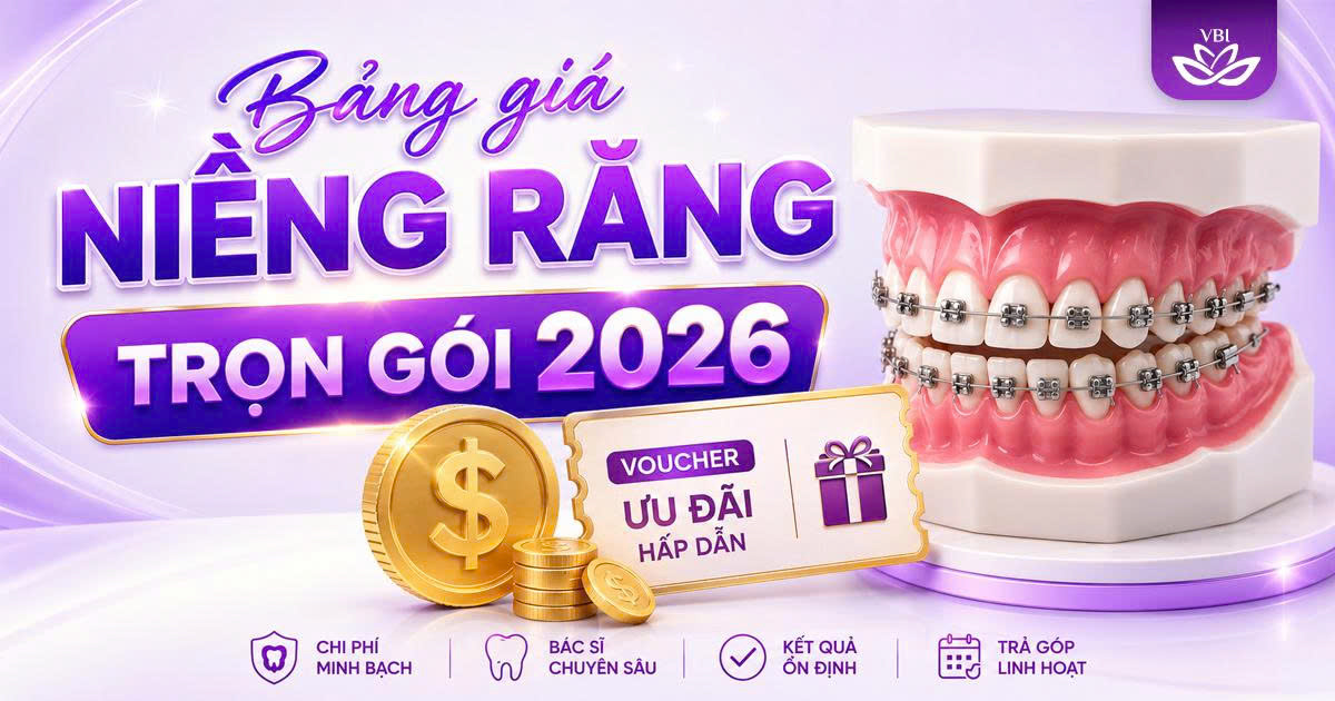 Bang-gia-nieng-rang-moi-nhat-2026-tai-He-thong-Nha-khoa-Viet-Bi
