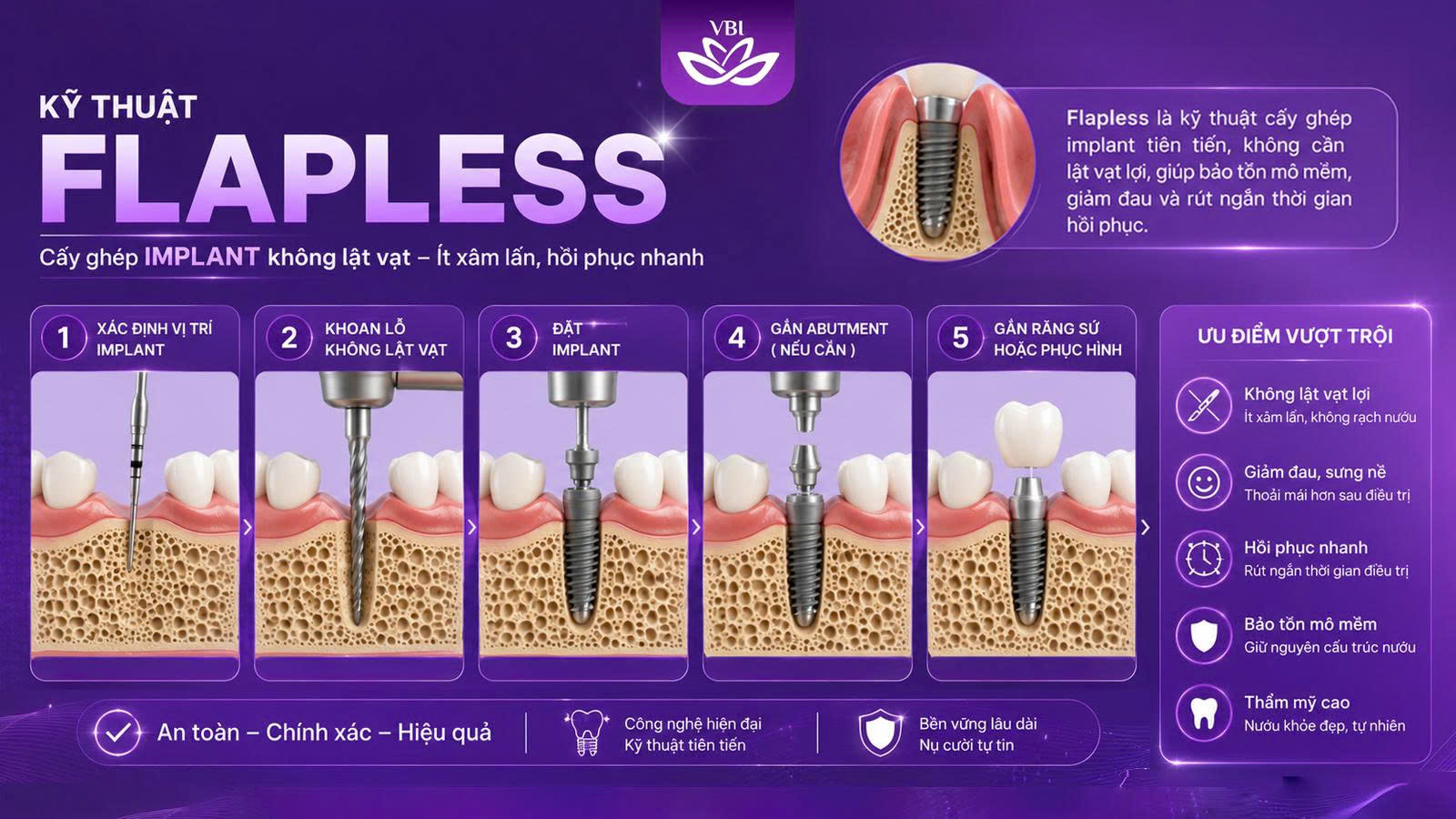 Trồng răng Implant có đau không với công nghệ flapless implant