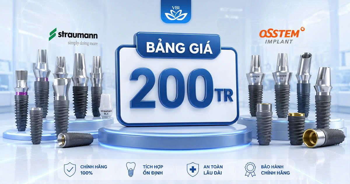 Bang-gia-trong-rang-Implant-2026