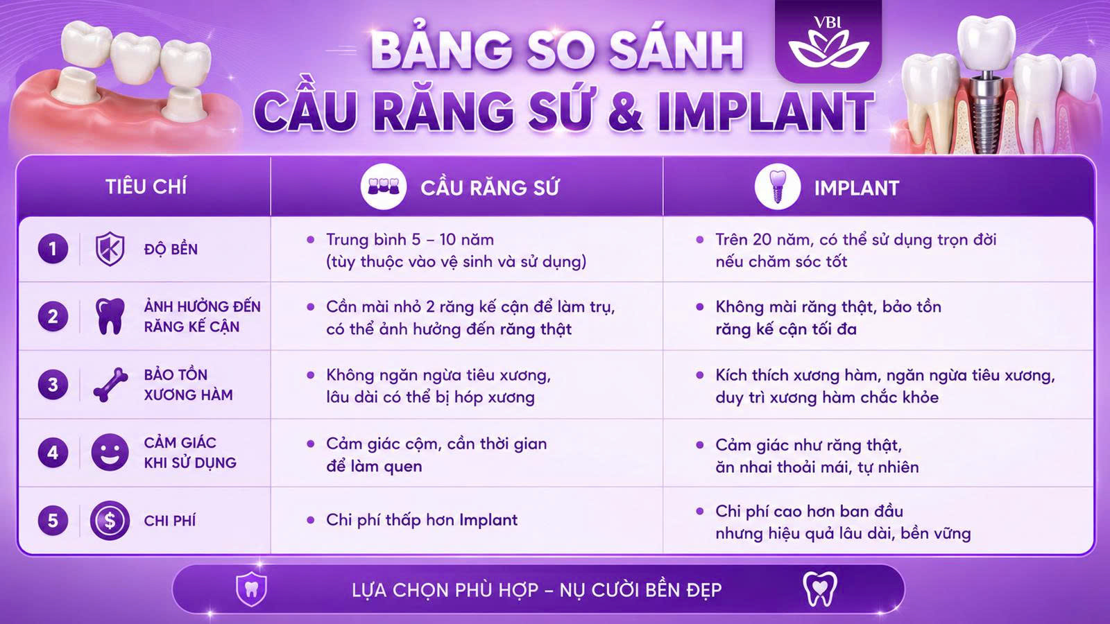 Bảng so sánh chi tiết cầu răng sứ và implant phục hình răng số 7