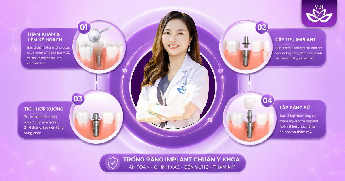 Quy-trinh-trong-rang-Implant-chuan-y-khoa