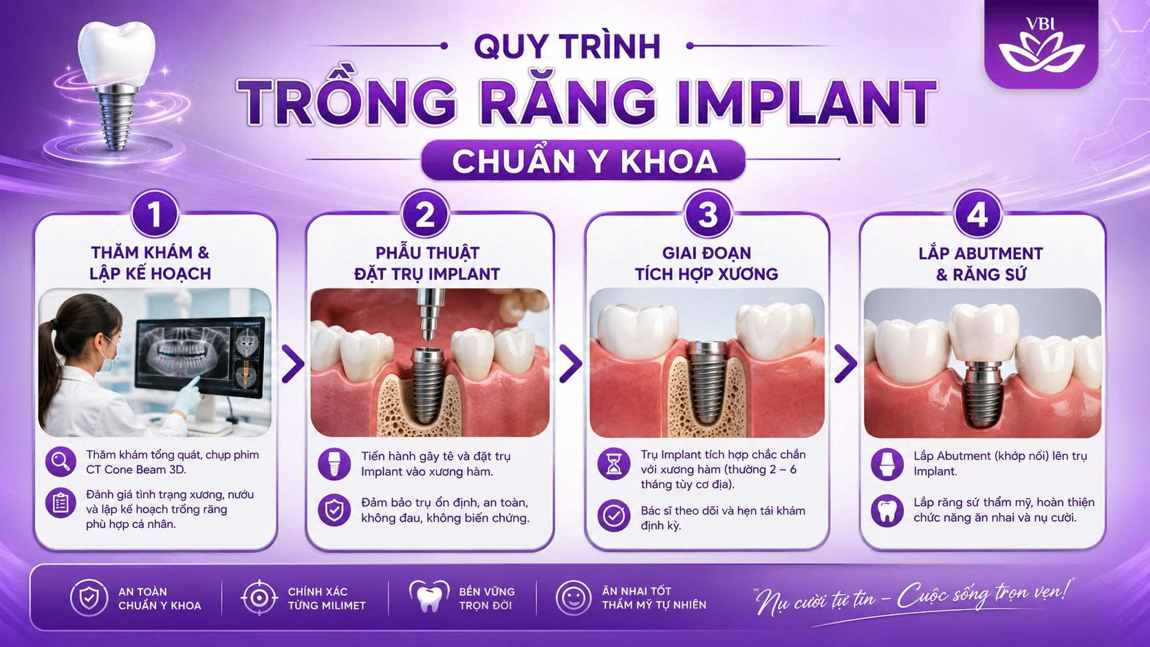Sơ đồ quy trình trồng răng implant chuẩn y khoa 4 bước an toàn