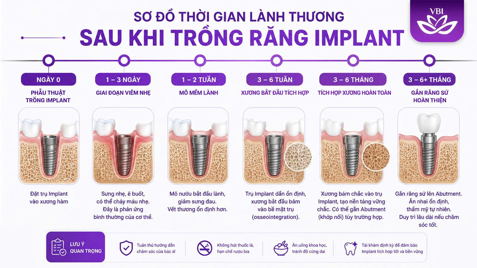 Sơ đồ thời gian nhổ răng bao lâu thì trồng lại được chuẩn y khoa