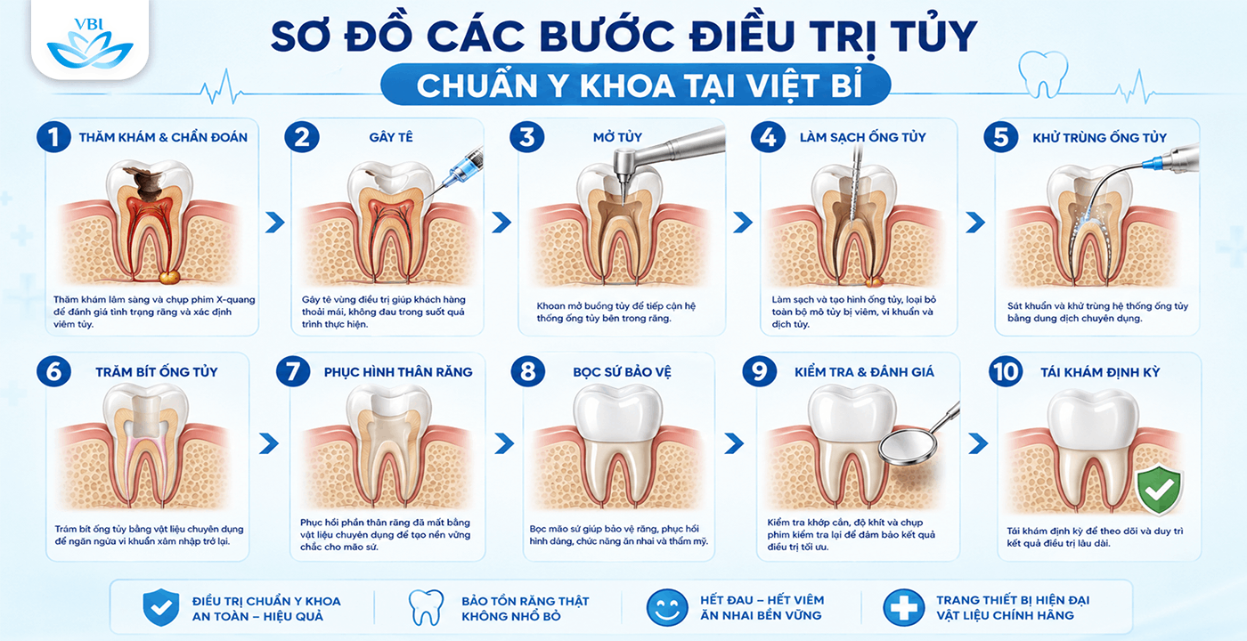 Chữa tủy răng ở đâu tốt Hà Nội
