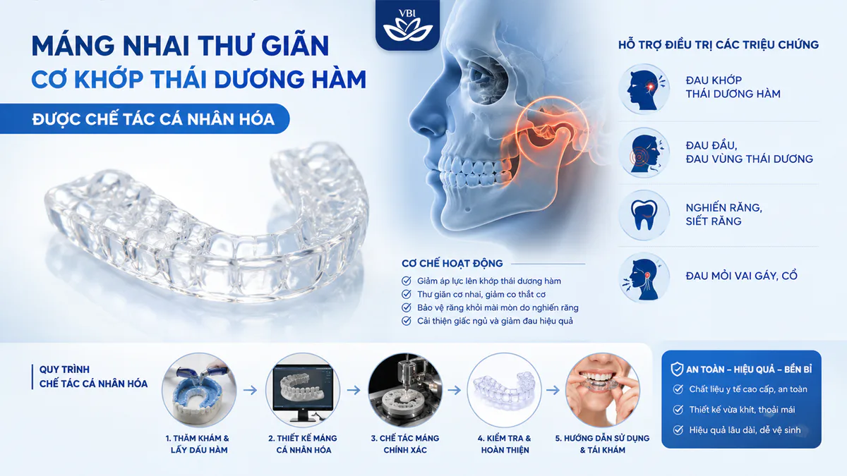 Máng nhai thư giãn cơ khớp thái dương hàm được chế tác cá nhân hóa