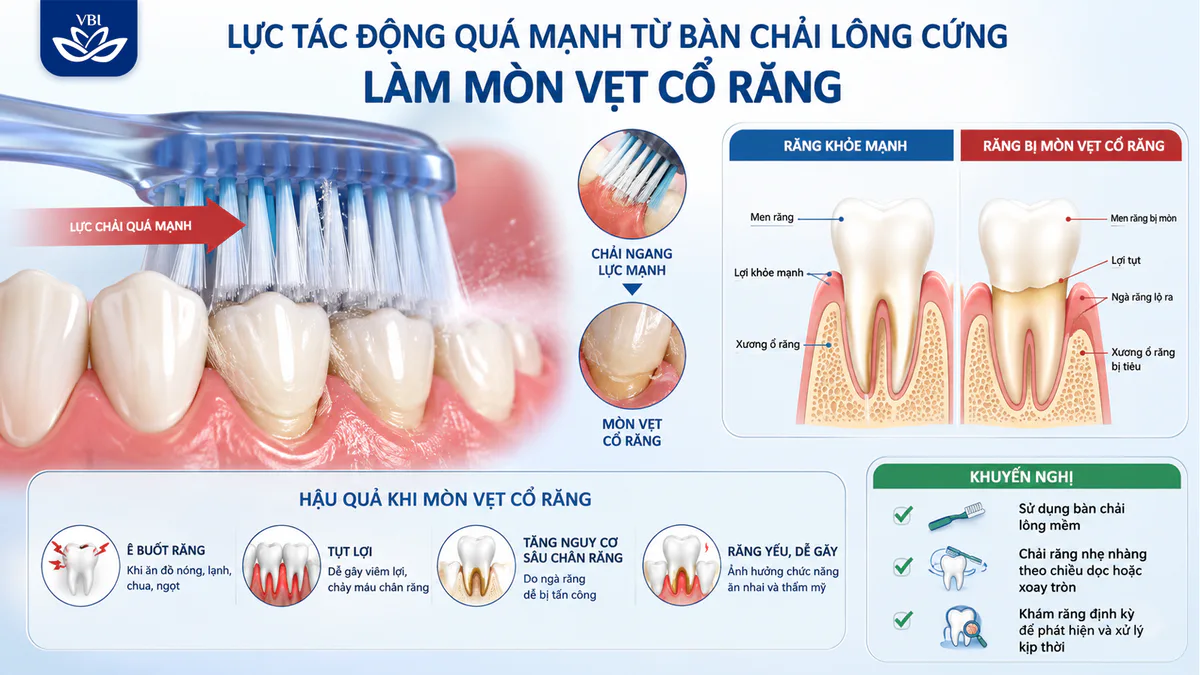 thói quen hỏng răng