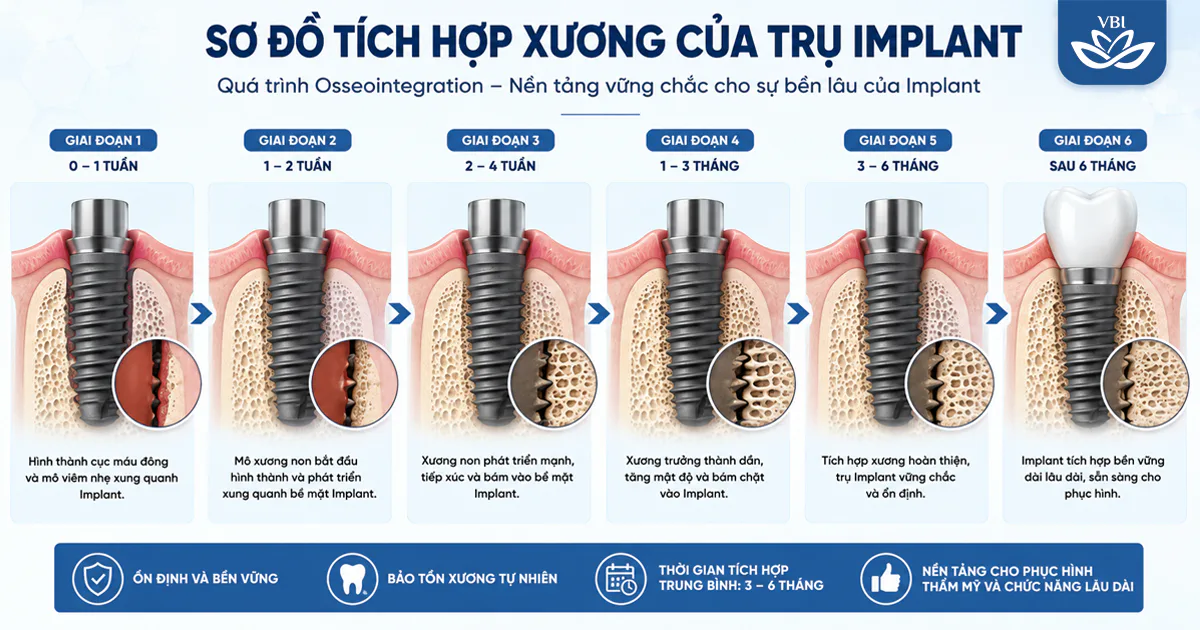 Trồng răng Implant cho người tiểu đường, huyết áp cao được không? Tư vấn từ bác sĩ